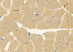 CELSR1 Polyclonal Antibody