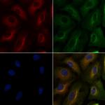 PTGER1 Polyclonal Antibody