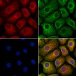 GPR179 Polyclonal Antibody