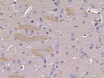 GPR179 Antibody in Immunohistochemistry (Paraffin) (IHC (P))