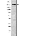 GPR179 Antibody in Western Blot (WB)