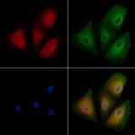 OR10H5 Polyclonal Antibody