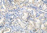 OR52B6 Polyclonal Antibody
