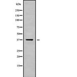 OR52B6 Antibody in Western Blot (WB)