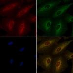 OR52E6/OR52E8 Polyclonal Antibody