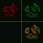 Opsin Blue Polyclonal Antibody