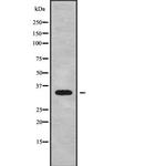 OR12D2 Antibody in Western Blot (WB)