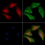 OR1A2 Polyclonal Antibody