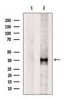 OR2B3 Polyclonal Antibody