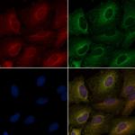OR4D2 Polyclonal Antibody