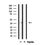 OR4D5 Antibody in Western Blot (WB)