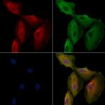 OR5T3 Polyclonal Antibody