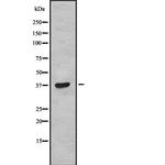 TAS2R38 Polyclonal Antibody