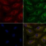 TAS2R9 Polyclonal Antibody