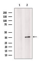 OR52K2 Polyclonal Antibody