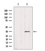OR52L2P Polyclonal Antibody