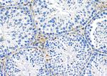 OR52M1 Polyclonal Antibody