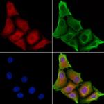 OR52N5 Polyclonal Antibody