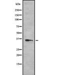OR52N5 Antibody in Western Blot (WB)