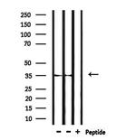 OR52P1P Polyclonal Antibody