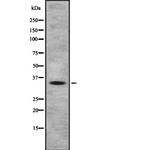 OR4A47 Polyclonal Antibody