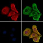 OR4N2 Polyclonal Antibody