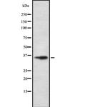 OR5M1 Polyclonal Antibody