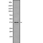 TAS2R30 Polyclonal Antibody