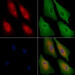 U12 Antibody in Immunocytochemistry (ICC/IF)