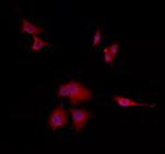 TPI1 Polyclonal Antibody