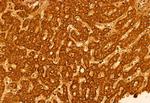 ECHS1 Polyclonal Antibody