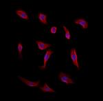 CAMSAP2 Polyclonal Antibody