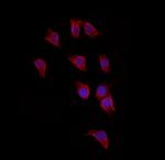 TMPRSS4 Polyclonal Antibody