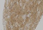 TMPRSS4 Antibody in Immunohistochemistry (Paraffin) (IHC (P))