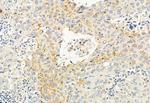 TMPRSS4 Antibody in Immunohistochemistry (Paraffin) (IHC (P))
