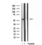 TMPRSS4 Antibody in Western Blot (WB)