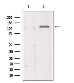 TMEM67 Polyclonal Antibody
