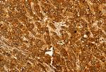 Pallidin Polyclonal Antibody