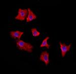 EXOC2 Polyclonal Antibody