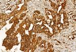 EXOC2 Antibody in Immunohistochemistry (Paraffin) (IHC (P))