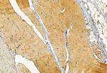 TOM70 Antibody in Immunohistochemistry (Paraffin) (IHC (P))