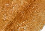 TOM70 Polyclonal Antibody