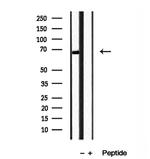 TOM70 Antibody in Western Blot (WB)