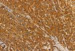 TAGLN2 Polyclonal Antibody