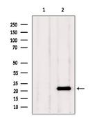 TAGLN2 Antibody in Western Blot (WB)