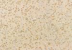 CHCHD2 Polyclonal Antibody