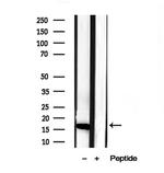 CHCHD2 Antibody in Western Blot (WB)