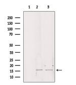 CHCHD2 Antibody in Western Blot (WB)