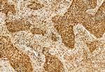 DDX21 Antibody in Immunohistochemistry (Paraffin) (IHC (P))