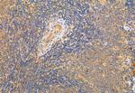 GDI2 Antibody in Immunohistochemistry (Paraffin) (IHC (P))